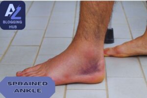 sprained ankle