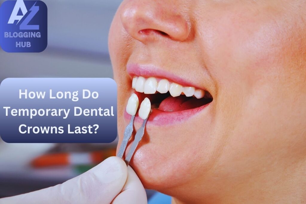 How Long Do Temporary Dental Crowns Last?